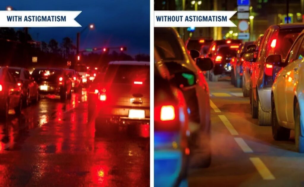 Apakah Mata Buram Selalu Karena Mata Minus? Bisa Jadi Astigmatisme!